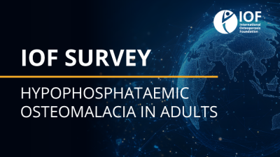 HO survey