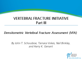 Vertebral Fracture Teaching Programme - Part3