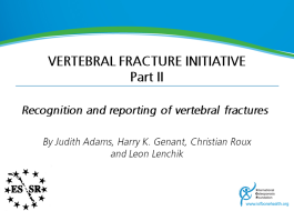 Vertebral Fracture Teaching Programme - Part2