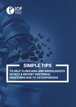 Vertebral Fracture Detection Tips