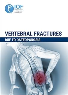 FACTSHEETS - Vertebral Fracture